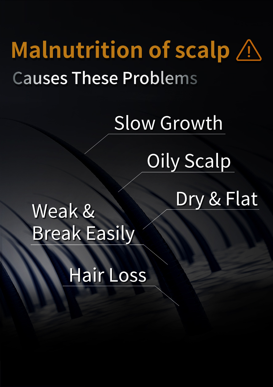 Deficient nutrition of hair roots causes oily scalp